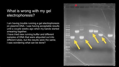 interpreting gel electrophoresis results